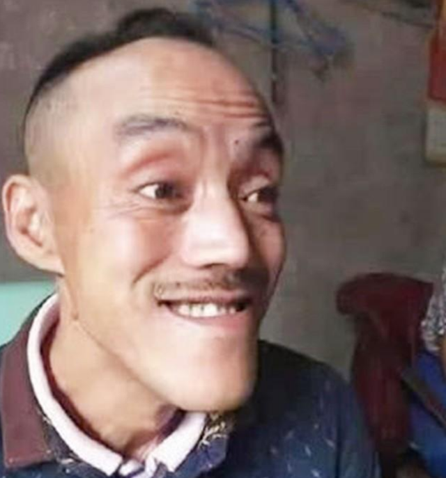 此人靠“光头强”走红，娶网红开豪车，后媳妇跑路，开摩的讨生活