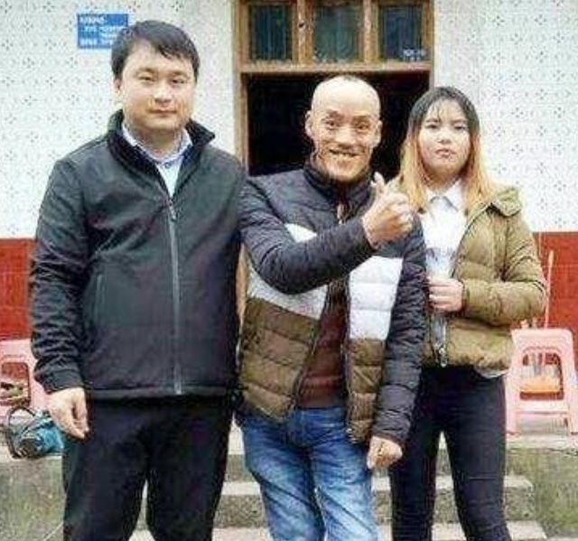 此人靠“光头强”走红，娶网红开豪车，后媳妇跑路，开摩的讨生活