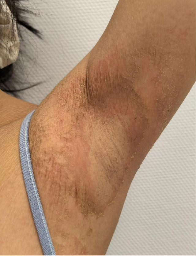 年轻女主播全身脱皮、奇痒不止！只因24小时都在…紧急提醒！