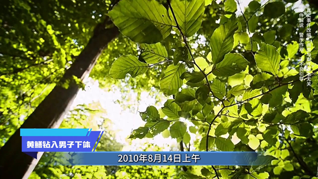 社会放大镜丨黄鳝钻入男子下体 #内容过于真实#真实还原