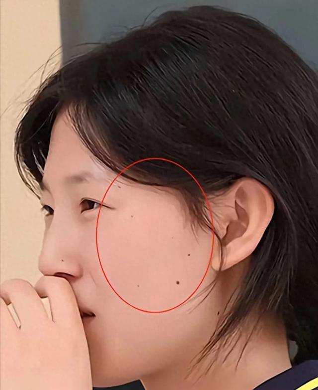 【震惊一刻】姜萍爆红背后的神秘面纱：她的脸颊藏着北斗七星痣！