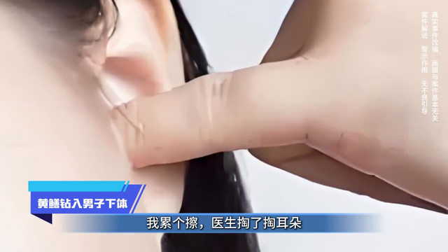 社会放大镜丨黄鳝钻入男子下体 #内容过于真实#真实还原