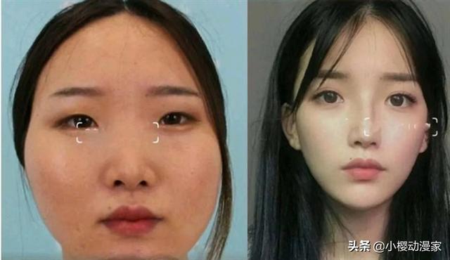 某女子花三十万整容，看完前后对比，终于明白宅男喜欢二次元原因