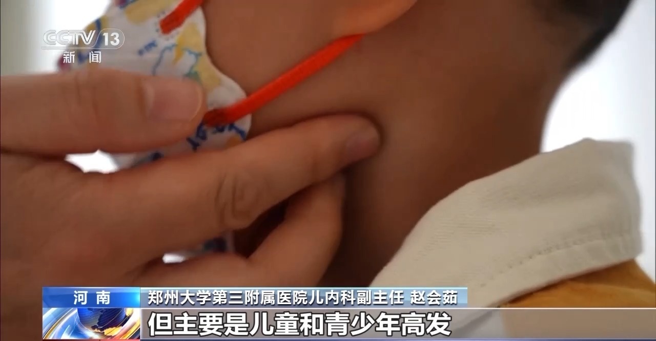 孩子不能又亲又抱 当心“亲吻病”→