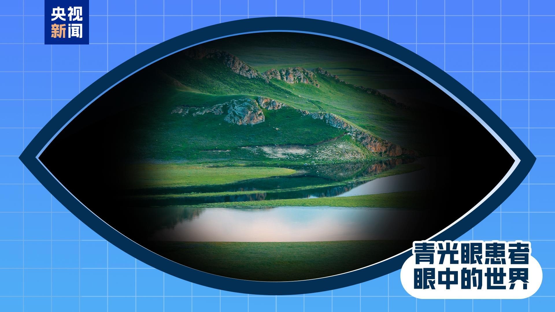 全国爱眼日丨出现这些症状 是眼睛在报警!